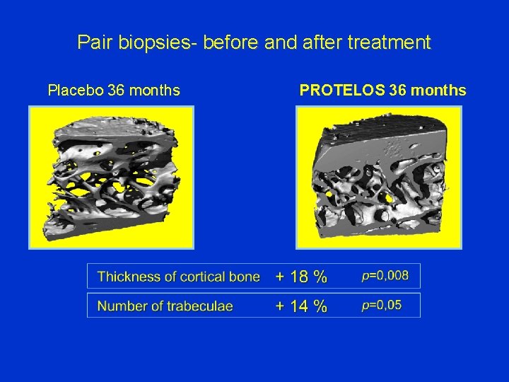 Pair biopsies- before and after treatment Placebo 36 months PROTELOS 36 months 