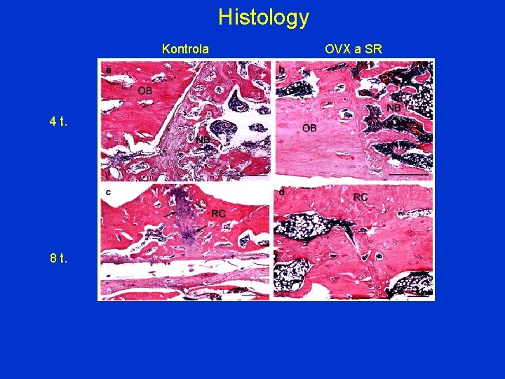 Histology Kontrola OVX a SR 4 t. 8 t. 