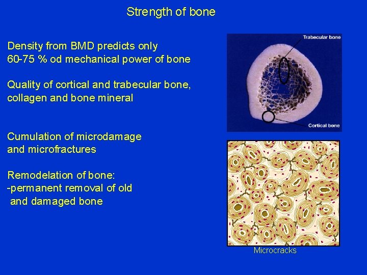 Strength of bone Density from BMD predicts only 60 -75 % od mechanical power