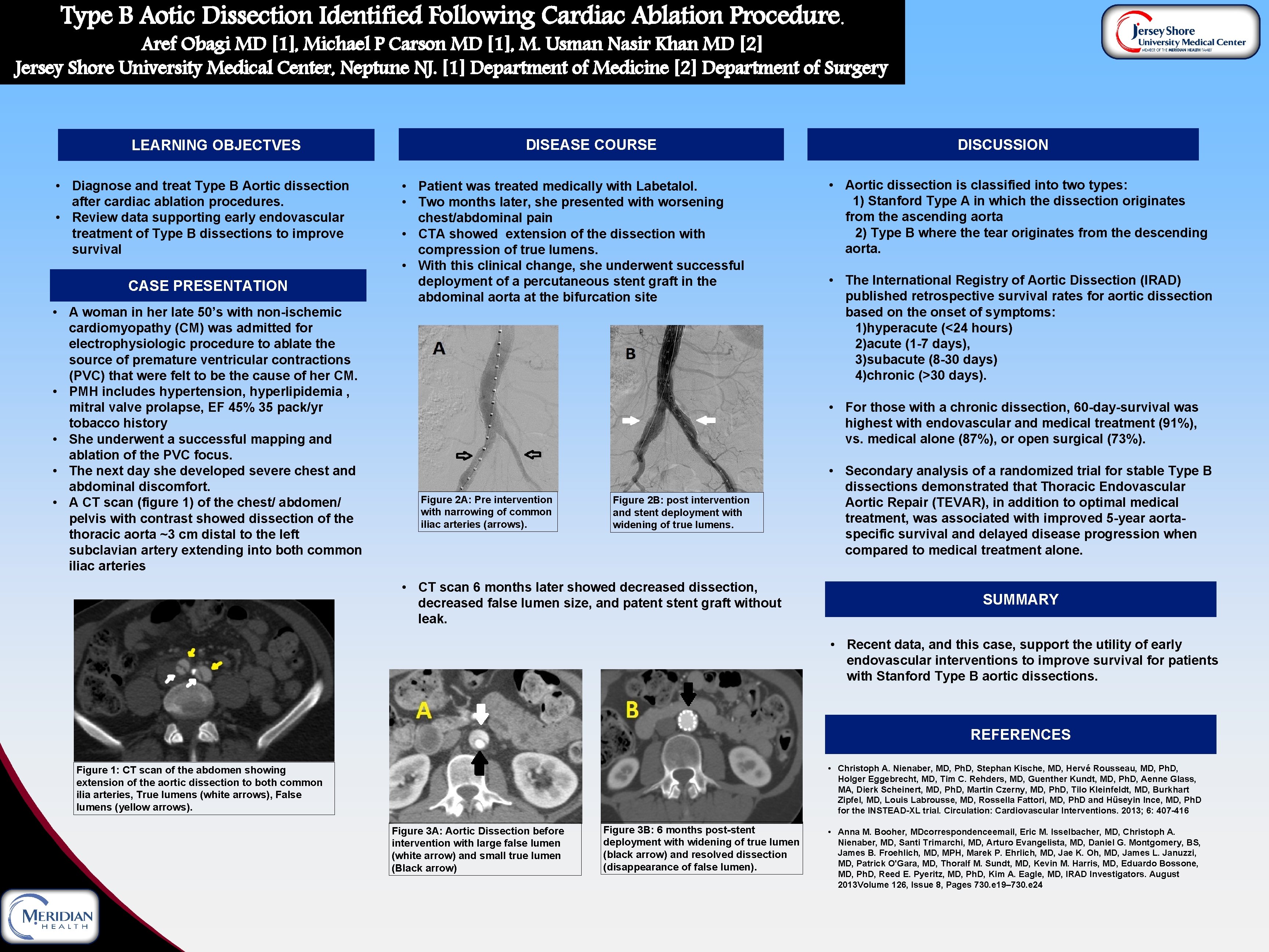 Type B Aotic Dissection Identified Following Cardiac Ablation Procedure. Aref Obagi MD [1], Michael