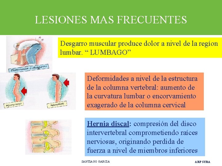 LESIONES MAS FRECUENTES Desgarro muscular produce dolor a nivel de la regíon lumbar. “