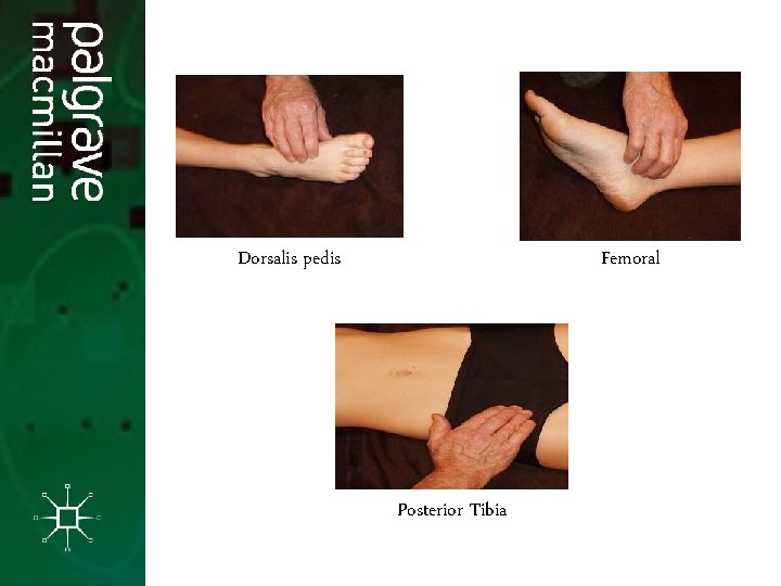 Dorsalis pedis Femoral Posterior Tibia Dorsalis pedis Femoral Posterior Tibia