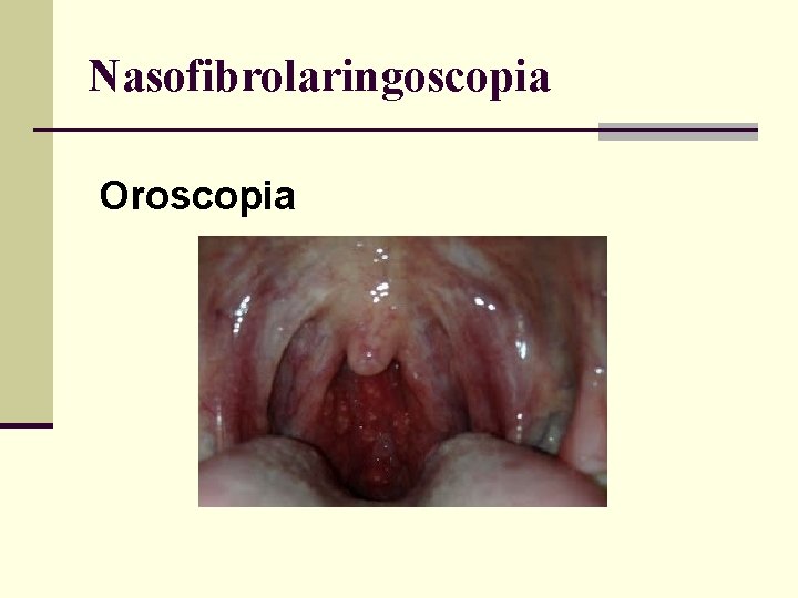 Nasofibrolaringoscopia Oroscopia 