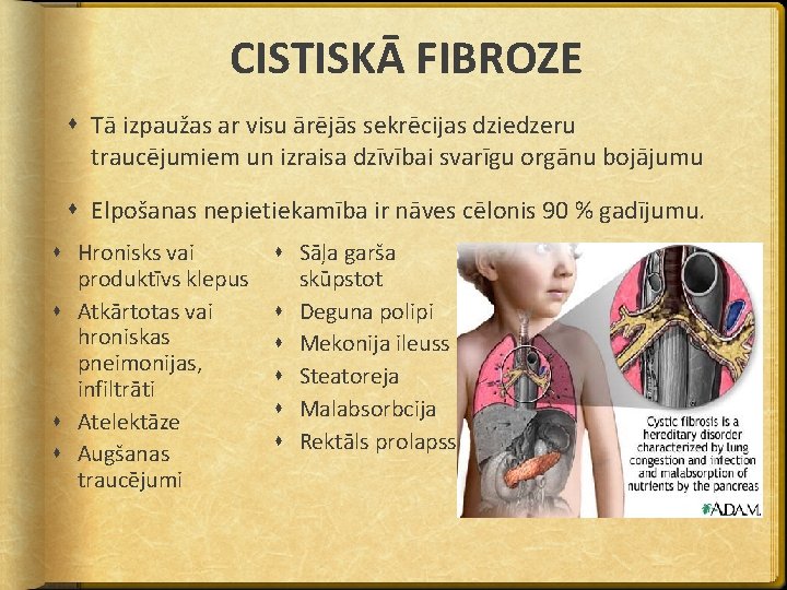 CISTISKĀ FIBROZE Tā izpaužas ar visu ārējās sekrēcijas dziedzeru traucējumiem un izraisa dzīvībai svarīgu