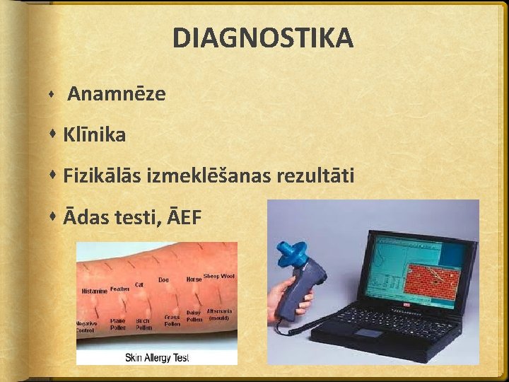 DIAGNOSTIKA Anamnēze Klīnika Fizikālās izmeklēšanas rezultāti Ādas testi, ĀEF 