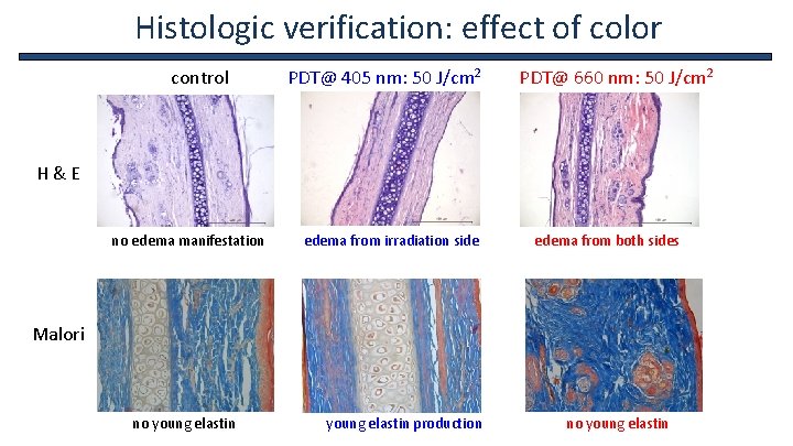Histologic verification: effect of color control PDT@ 405 nm: 50 J/cm 2 PDT@ 660