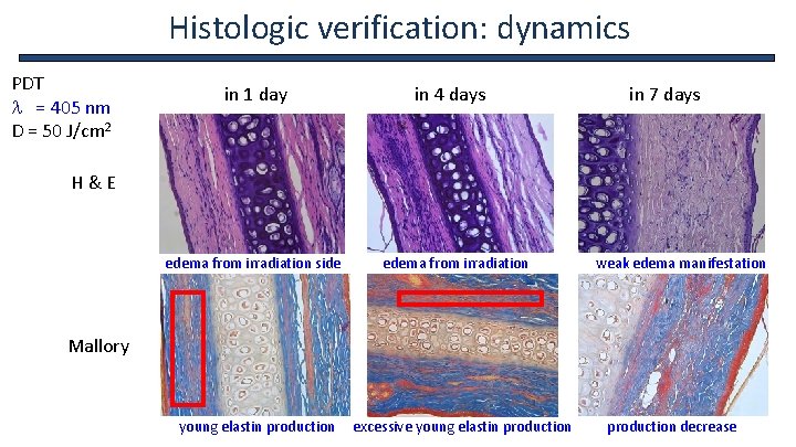 Histologic verification: dynamics PDT l = 405 nm D = 50 J/cm 2 in