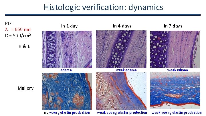 Histologic verification: dynamics PDT l = 660 nm D = 50 J/cm 2 in
