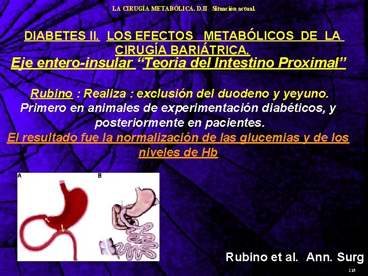 LA CIRUGÍA METABÓLICA. D. II Situación actual. DIABETES II. LOS EFECTOS METABÓLICOS DE LA