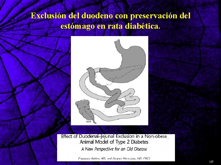 Exclusión del duodeno con preservación del estómago en rata diabética. 117 