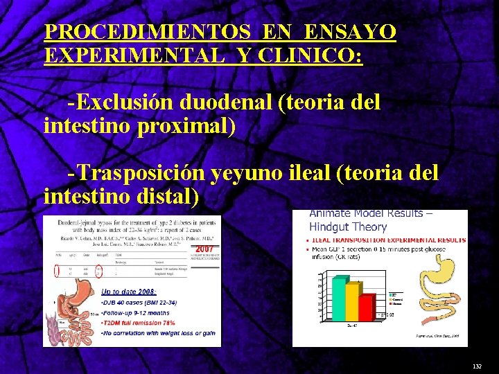 PROCEDIMIENTOS EN ENSAYO EXPERIMENTAL Y CLINICO: -Exclusión duodenal (teoria del intestino proximal) -Trasposición yeyuno