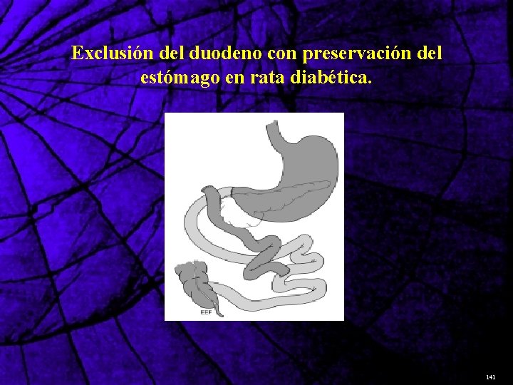 Exclusión del duodeno con preservación del estómago en rata diabética. 141 