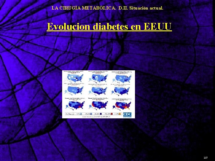 LA CIRUGÍA METABÓLICA. D. II. Situación actual. Evolucion diabetes en EEUU 157 