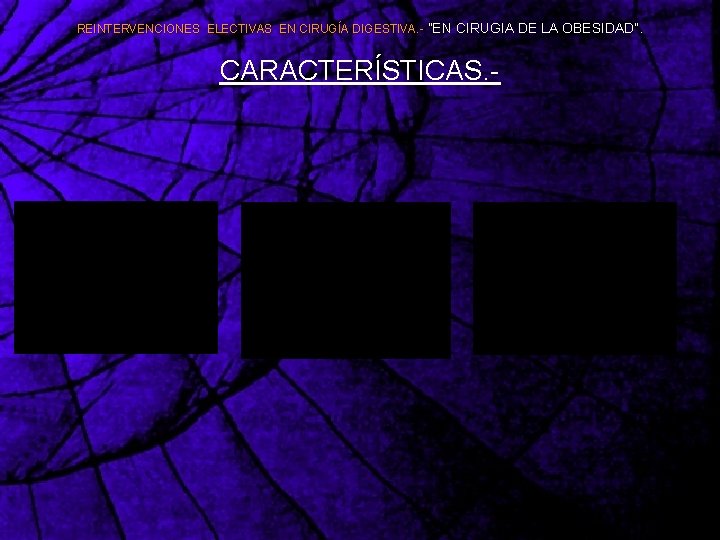 REINTERVENCIONES ELECTIVAS EN CIRUGÍA DIGESTIVA. - ”EN CIRUGIA DE LA OBESIDAD”. CARACTERÍSTICAS. - 