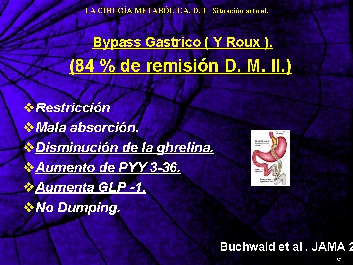 LA CIRUGÍA METABÓLICA. D. II Situación actual. Bypass Gastrico ( Y Roux ). (84