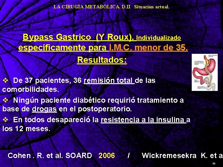 LA CIRUGÍA METABÓLICA. D. II Situación actual. Bypass Gastrico (Y Roux). Individualizado específicamente para