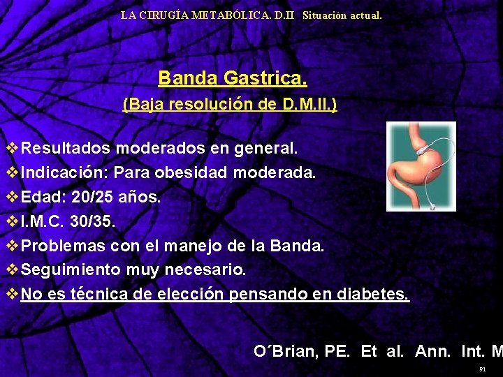 LA CIRUGÍA METABÓLICA. D. II Situación actual. Banda Gastrica. (Baja resolución de D. M.
