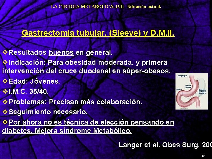 LA CIRUGÍA METABÓLICA. D. II Situación actual. Gastrectomía tubular. (Sleeve) y D. M. II.