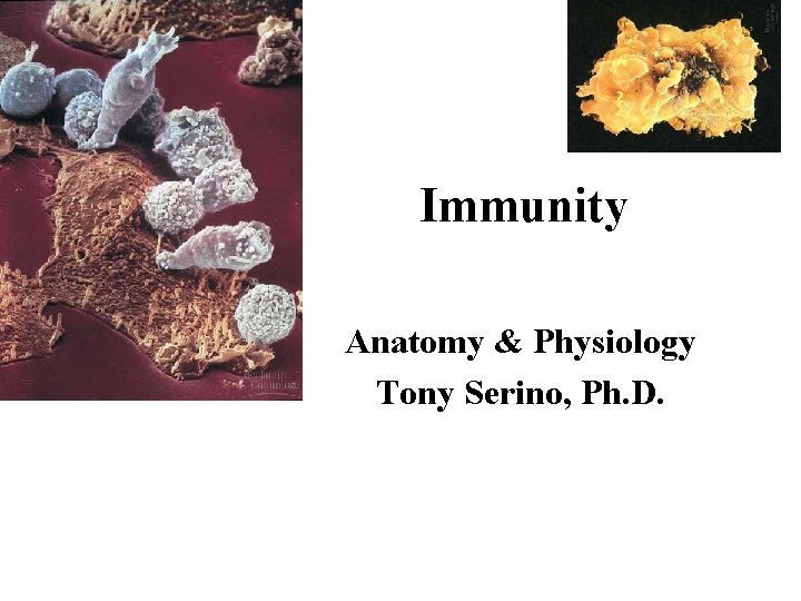 Immunity Anatomy & Physiology Tony Serino, Ph. D. 