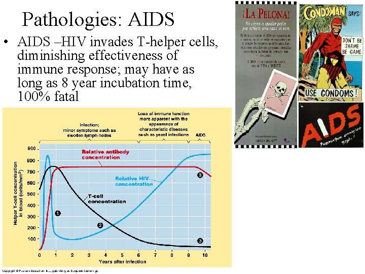 Pathologies: AIDS • AIDS –HIV invades T-helper cells, diminishing effectiveness of immune response; may