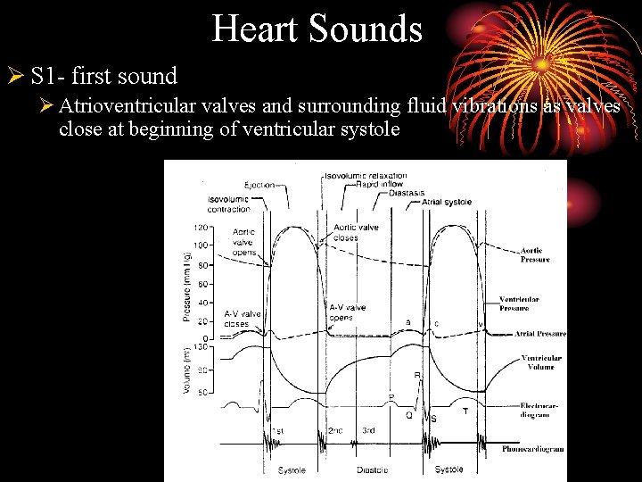 Heart Sounds Ø S 1 - first sound Ø Atrioventricular valves and surrounding fluid
