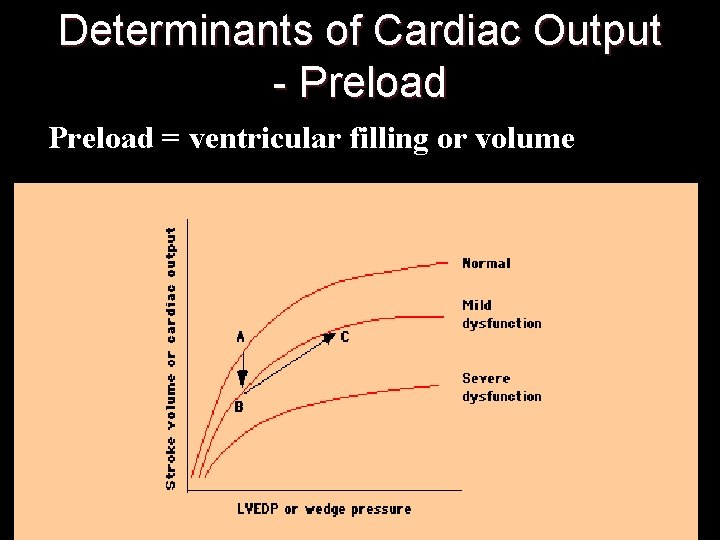 Determinants of Cardiac Output - Preload = ventricular filling or volume 