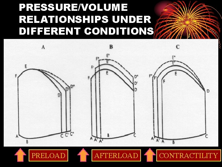 PRESSURE/VOLUME RELATIONSHIPS UNDER DIFFERENT CONDITIONS PRELOAD AFTERLOAD CONTRACTILITY 