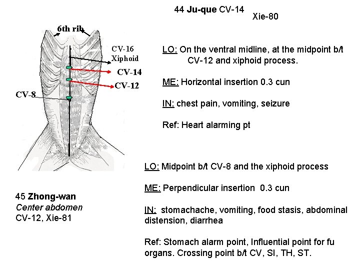 44 Ju-que CV-14 Xie-80 6 th rib CV-16 Xiphoid CV-8 CV-14 CV-12 LO: On