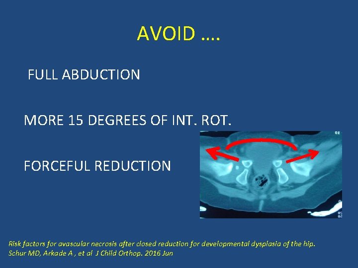 AVOID …. FULL ABDUCTION MORE 15 DEGREES OF INT. ROT. FORCEFUL REDUCTION Risk factors