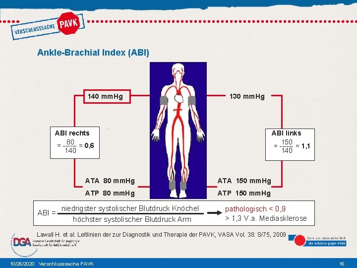 Ankle-Brachial Index (ABI) 140 mm. Hg 130 mm. Hg ABI rechts 80 = 0,