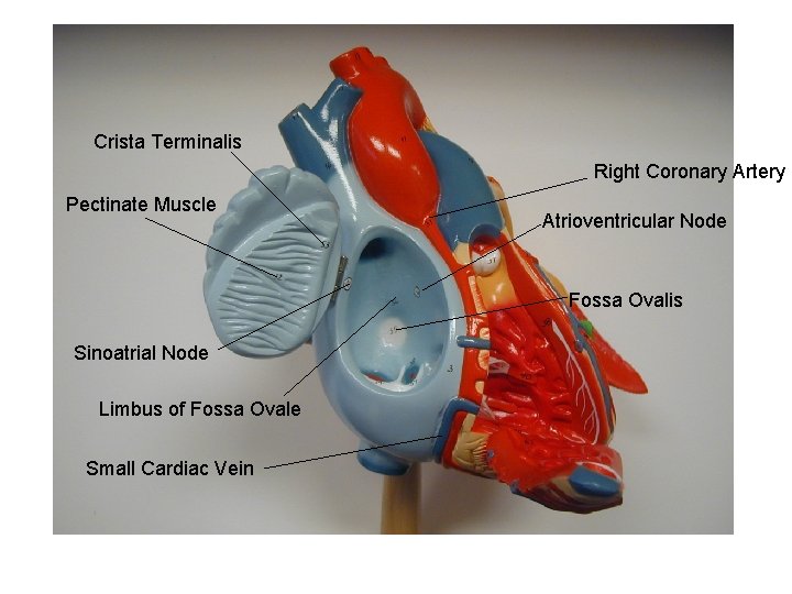 Crista Terminalis Right Coronary Artery Pectinate Muscle Atrioventricular Node Fossa Ovalis Sinoatrial Node Limbus