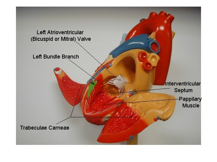 Left Atrioventricular (Bicuspid or Mitral) Valve Left Bundle Branch Interventricular Septum Pappilary Muscle Trabeculae