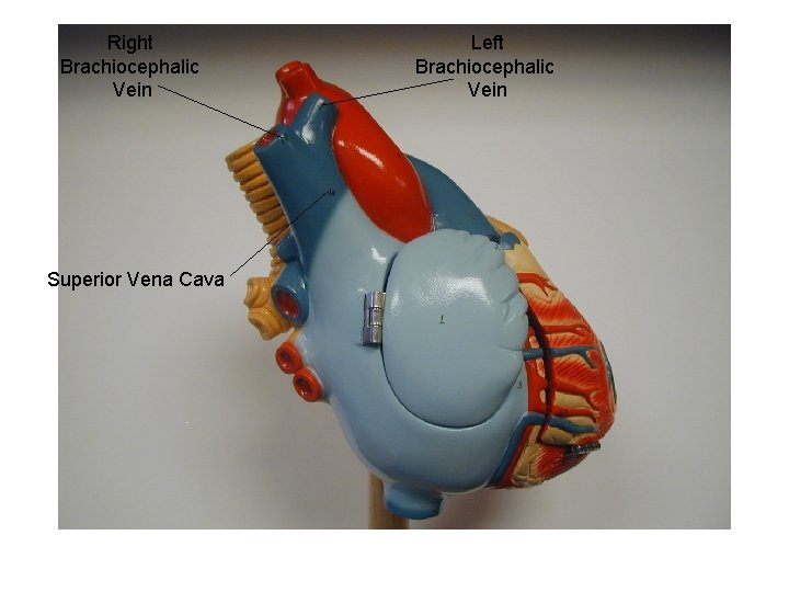 Right Brachiocephalic Vein Superior Vena Cava Left Brachiocephalic Vein 