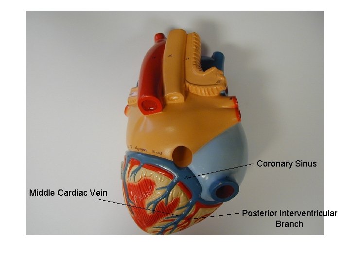 Coronary Sinus Middle Cardiac Vein Posterior Interventricular Branch 