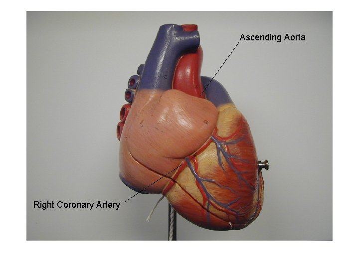 Ascending Aorta Right Coronary Artery 