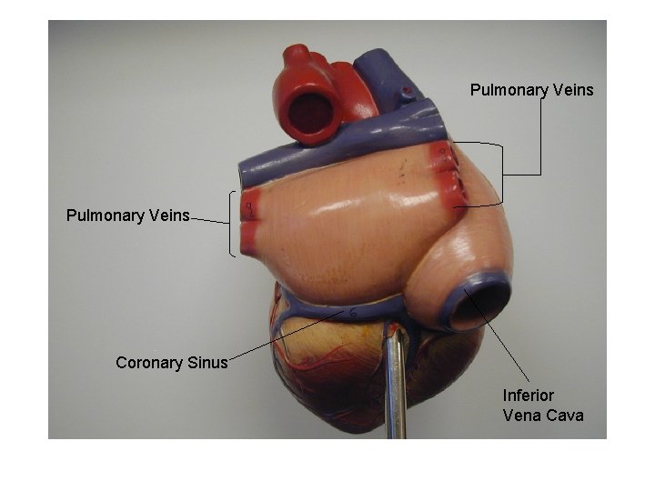 Pulmonary Veins Coronary Sinus Inferior Vena Cava 