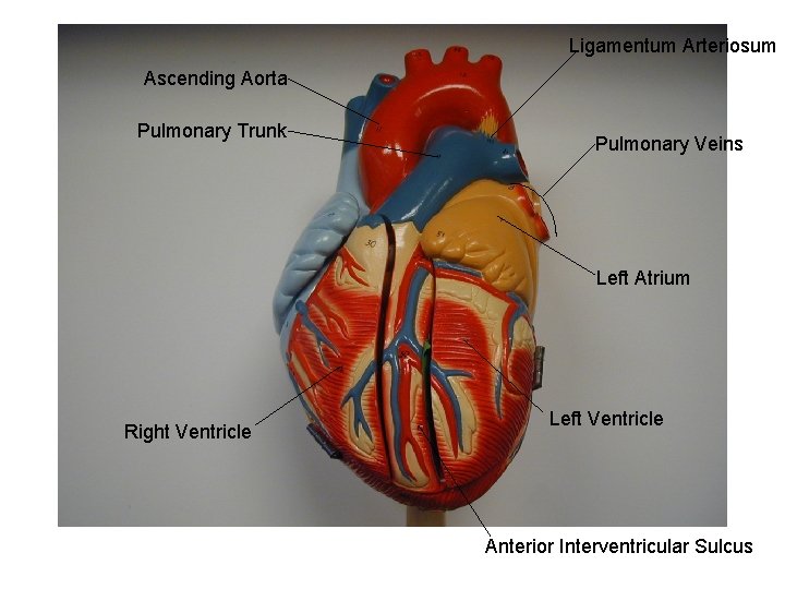Ligamentum Arteriosum Ascending Aorta Pulmonary Trunk Pulmonary Veins Left Atrium Right Ventricle Left Ventricle