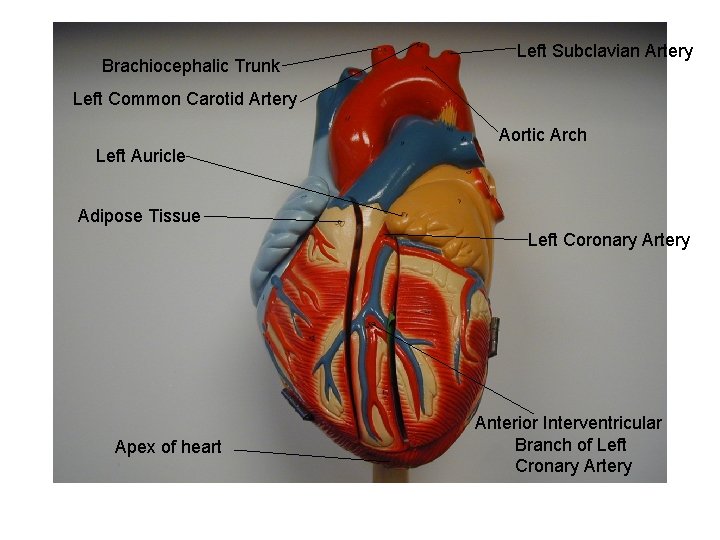 Brachiocephalic Trunk Left Subclavian Artery Left Common Carotid Artery Aortic Arch Left Auricle Adipose