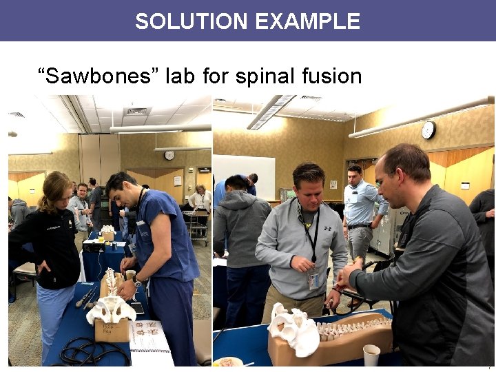 SOLUTION EXAMPLE “Sawbones” lab for spinal fusion 7 