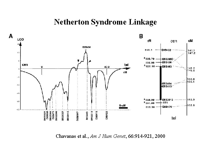 Netherton Syndrome Linkage Chavanas et al. , Am J Hum Genet, 66: 914 -921,
