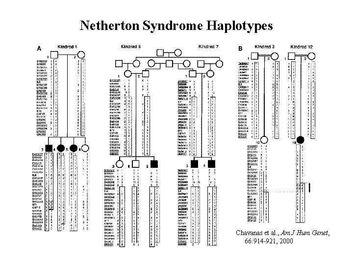 Netherton Syndrome Haplotypes Chavanas et al. , Am J Hum Genet, 66: 914 -921,