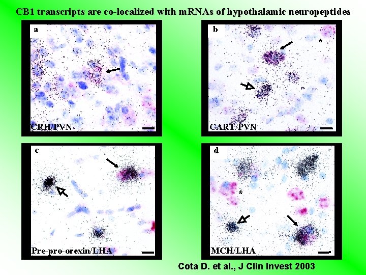 CB 1 transcripts are co-localized with m. RNAs of hypothalamic neuropeptides a b * CB 1 transcripts are co-localized with m. RNAs of hypothalamic neuropeptides a b *