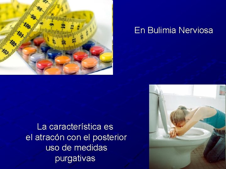 En Bulimia Nerviosa La característica es el atracón con el posterior uso de medidas