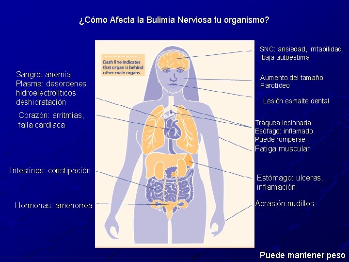 ¿Cómo Afecta la Bulimia Nerviosa tu organismo? SNC: ansiedad, irritabilidad, baja autoestima Sangre: anemia