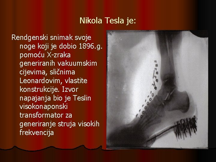 Nikola Tesla je: Rendgenski snimak svoje noge koji je dobio 1896. g. pomoću X-zraka Nikola Tesla je: Rendgenski snimak svoje noge koji je dobio 1896. g. pomoću X-zraka