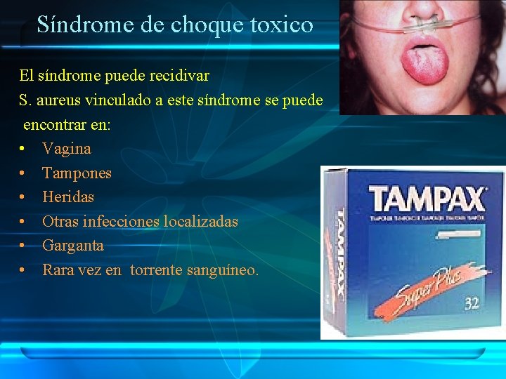 Síndrome de choque toxico El síndrome puede recidivar S. aureus vinculado a este síndrome