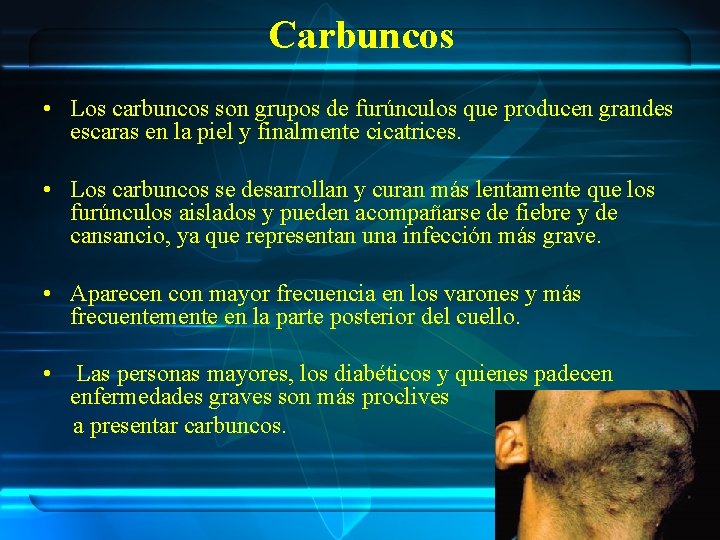 Carbuncos • Los carbuncos son grupos de furúnculos que producen grandes escaras en la