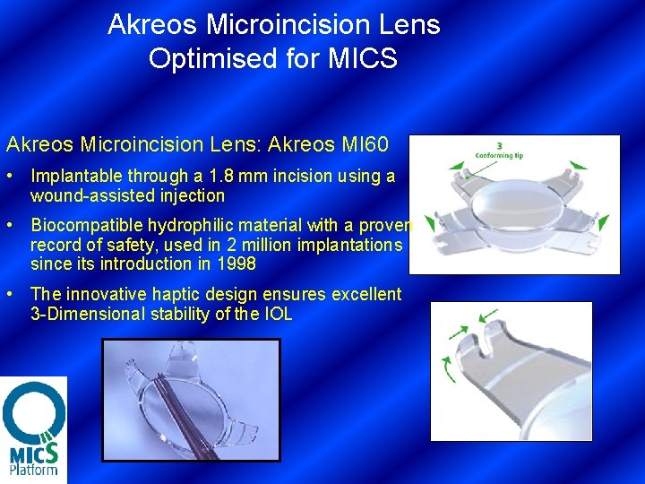 Akreos Microincision Lens Optimised for MICS Akreos Microincision Lens: Akreos MI 60 • Implantable