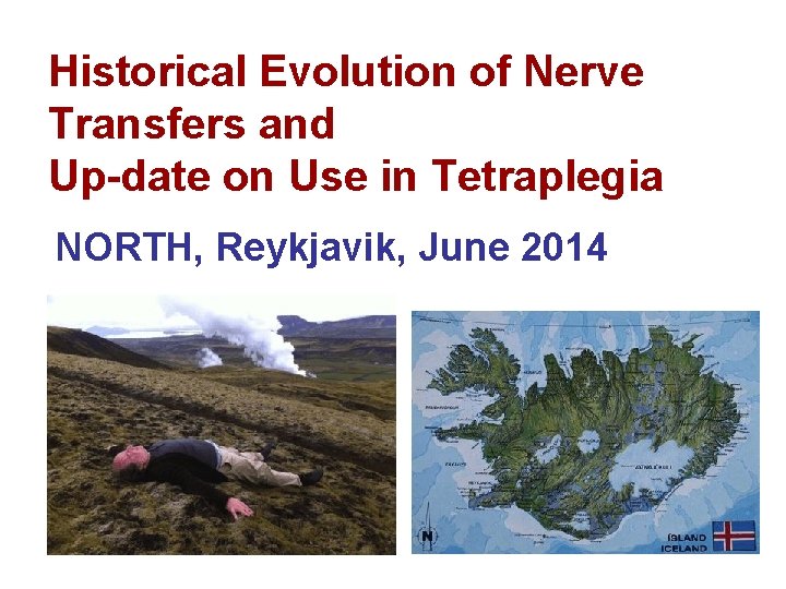 Historical Evolution of Nerve Transfers and Up-date on Use in Tetraplegia NORTH, Reykjavik, June