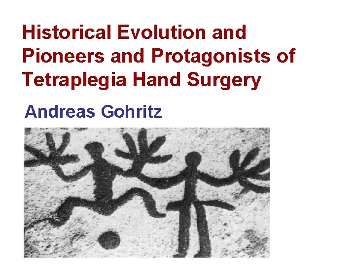 Historical Evolution and Pioneers and Protagonists of Tetraplegia Hand Surgery Andreas Gohritz 